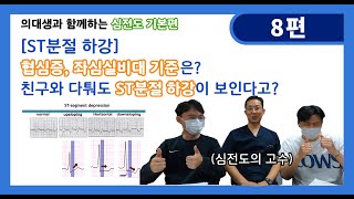 의대생과 함께하는 심전도 기본편 I 8편ST분절 하강협심증좌심실비대 기준은 친구와 다퉈도 ST분절 하강이 보인다고 [upl. by Ardnasirhc]