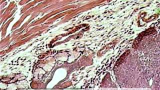 Skeletal muscle under microscope [upl. by Tierza]