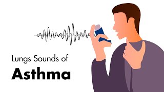 Sounds of Asthma  Wheezing Lung Sounds [upl. by Enautna]