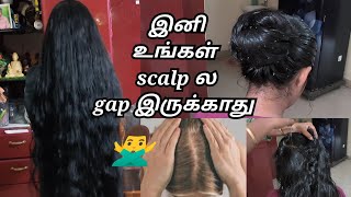 👉Scalp க்கும் Hair க்கும் இது மட்டுமே போதும் முடி அடர்த்தியா வளரSanaTamil [upl. by Schmitt112]