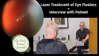 YAG Laser Eye Floater Treatment w Interview with Patient [upl. by Llegna]