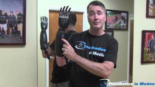 Below The Elbow Amputee Demonstrates BeBionic 3 Myoelectric Prosthesis [upl. by Antoni944]