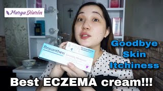 THE BEST ECZEMA CREAM  Bepanthen Review  Marga Diaries [upl. by Haron]