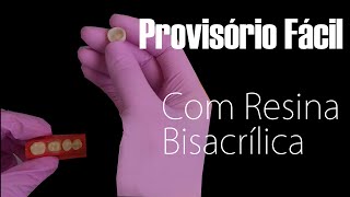 Provisório Fácil Com Resina Bisacrílica [upl. by Anaic838]