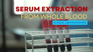 Serum Extraction from Whole Blood [upl. by Eirtemed]