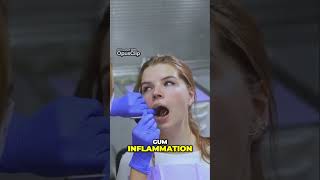 Troubleshooting Your Oral Health Solutions for Common Issues dental dentalhealth shortsvideo [upl. by Eceertal95]