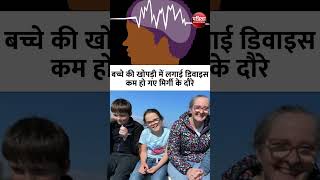 Epilepsy Warning बच्चे की खोपड़ी में लगाई डिवाइस कम हो गए मिर्गी के दौरे  Epilepsy Seizure [upl. by Einamrej]