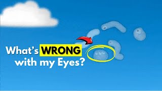 What are those floating things in your eyes  Eye Floaters Explained [upl. by Auqinat]