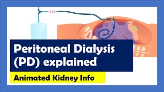 Peritoneal Dialysis explained [upl. by Durston]