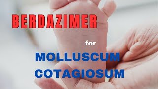 MOLLUSCUM CONTAGIOSUM Treatment update  BERDAZIMER GEL [upl. by Joly]