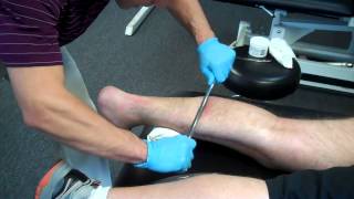 Graston Technique  Foot amp Plantar Fasciitis [upl. by Dag194]