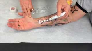 How to apply EMLA numbing cream for laser tattoo removal [upl. by Odrareve764]