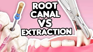 Root Canal vs Tooth Extraction What’s the Right Choice [upl. by Irotal529]