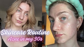 Skincare Routine  Acne in my 30s [upl. by Shandy]