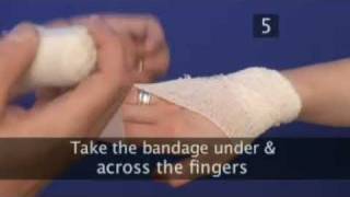 how to bandage a hand [upl. by Lemkul]