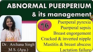 76ABNORMAL PUERPERIUM amp ITS MANAGEMENT Puerperal Pyrexia amp Breast Complications [upl. by Illak]