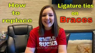 How to replace ligature tie or O Rings on Braces  How braces ties with Ligature ties [upl. by Axe]