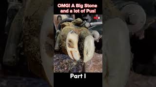 OMG A Big Stone and a lot of Pus tiktok fyp viral cow hoof hoofcare hoofpicking hoofcleani [upl. by Vijar]