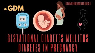 Diabetes in Pregnancy Gestational amp Overt diabetes  Investigations Management and Complications [upl. by Eicyal]