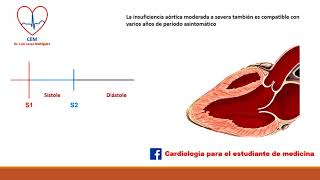 Auscultación de la insuficiencia aórtica [upl. by Kosiur]