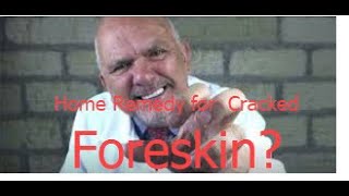 Home Remedy for Cracked Foreskin Heals Split Skin in Days [upl. by Aham]