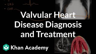 Valvular heart disease diagnosis and treatment  NCLEXRN  Khan Academy [upl. by Inasah719]