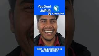 Best smile designing centre in india  smile makeover bestdentist youdentindiahospital implant [upl. by Ahcsrop]