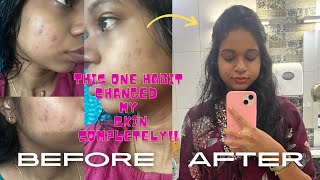 This One Habit Changed my Skin Health completely No Doctor No Treatments❤️Acne Skincare Tamil [upl. by Yruok]