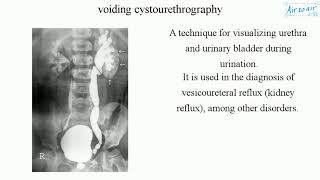 voiding cystourethrography [upl. by Artair76]