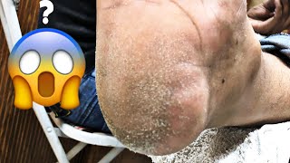 Amazing scraping soft skin  professionally removed dry [upl. by Curhan191]