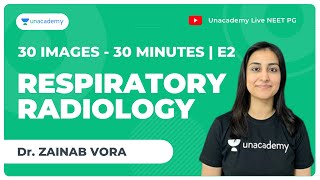 30 Images in 30 minutes  E2   Respiratory radiology  NEET PG  Dr Zainab Vora [upl. by Cianca]