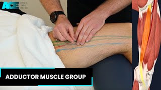 Dry Needling Adductor Muscle group [upl. by Nosraep963]