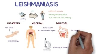 What is Leishmaniasis An introduction and overview [upl. by Cummins]