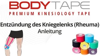 Kinesiology Tape Anleitung Entzündung des Kniegelenks Rheuma [upl. by Nagel]