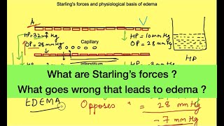 Starling forces hydrostatic pressure vs oncotic pressure  Pathophysiology of Edema [upl. by Nerval]