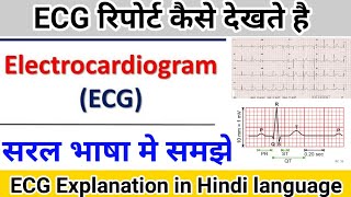 ECG report कैसे देखते है  Electrocardiogram explanation in hindi language [upl. by Jezabella]