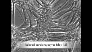 Enriched Cardiomyocytes  Beating from Day 1 [upl. by Hock67]