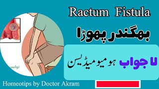 Fistula Kia Hai  Anal Fistula in Urdu  Fistula causes symptoms amp treatment  Bhagnadar ka ilaj [upl. by Lydnek668]