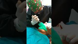 Cómo se realiza un Tratamiento de Conducto o Endodoncia paso a paso [upl. by Davidoff299]