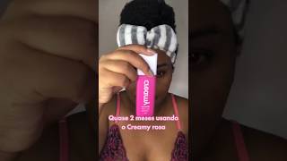 Como tirar manchas do rosto e diminuir a acne com creamy ácido mandélico skincare manchasnapele [upl. by Kreda]