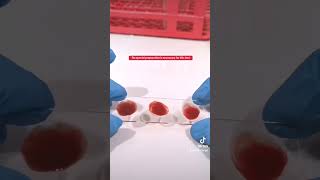 quotBquot positive blood type sample [upl. by Sualohcin]