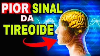 7 SINAIS PERIGOSOS do HIPERTIREOIDISMO Sintomas da Tireoide Produzindo Muitos Hormônios T3 e T4 [upl. by Prochoras]