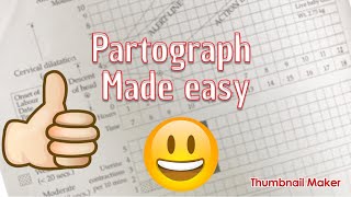 partograph made easy [upl. by Onia301]