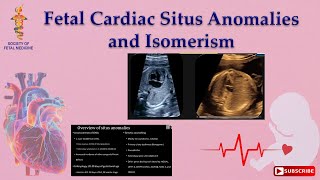 Fetal Cardiac Situs Anomalies and Isomerism [upl. by Amjan744]