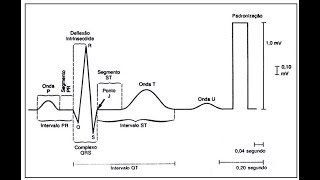 Aprenda a ler um Eletrocardiograma ECG [upl. by Nyladam693]