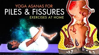 Piles Problem Treatment Part 2  Yoga for Piles  Cure Hemorrhoids with Simple Exercises piles [upl. by Ahsiram]