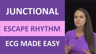 Junctional Escape Rhythm ECG Made Easy Nursing Next Generation NCLEX EKG [upl. by Eliason]