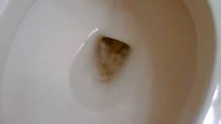 Simple trick to unclog unblock a toilet clogged up by excrement feces [upl. by Kovar]