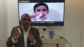 Otitis media with effusion Hindi Patient teaching programme [upl. by Anyaled971]