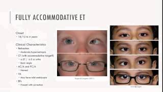 Fully Accomodative ET Characteristics [upl. by Salb]